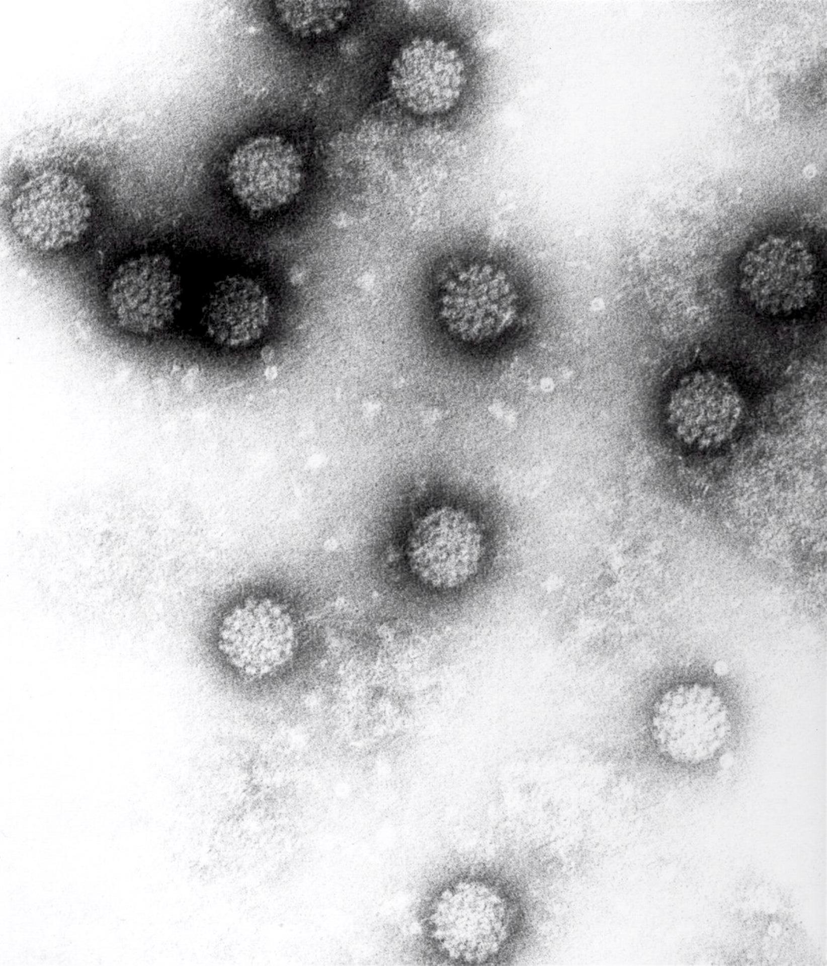 Imagen a través del microscopio del virus del papiloma humano. EFE/Instituto Alemán de Investigaciones sobre el Cáncer (DKFZ)/Handout