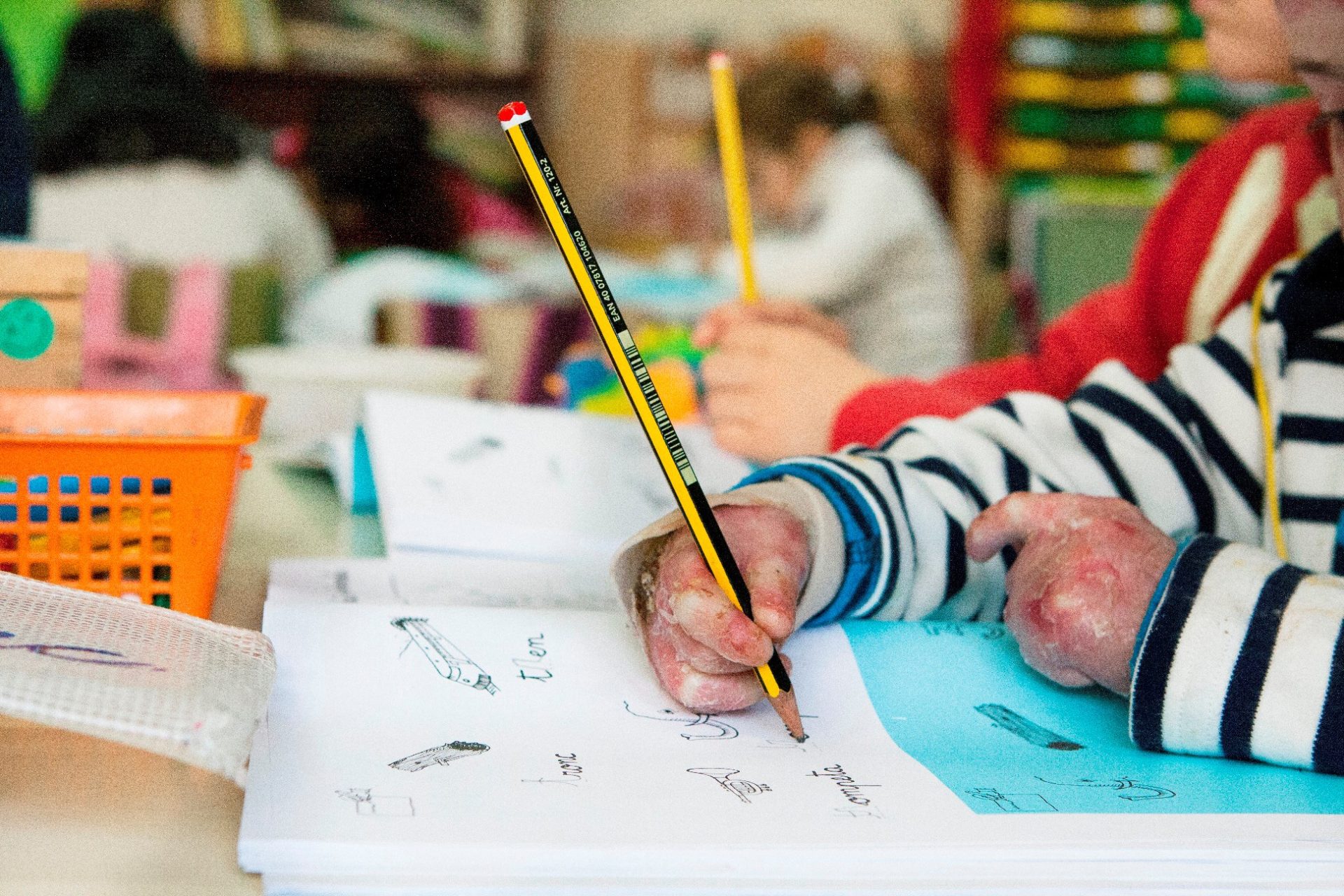 Un niño afectado por la enfermedad rara llamada Piel de mariposa escribe en un cuaderno.