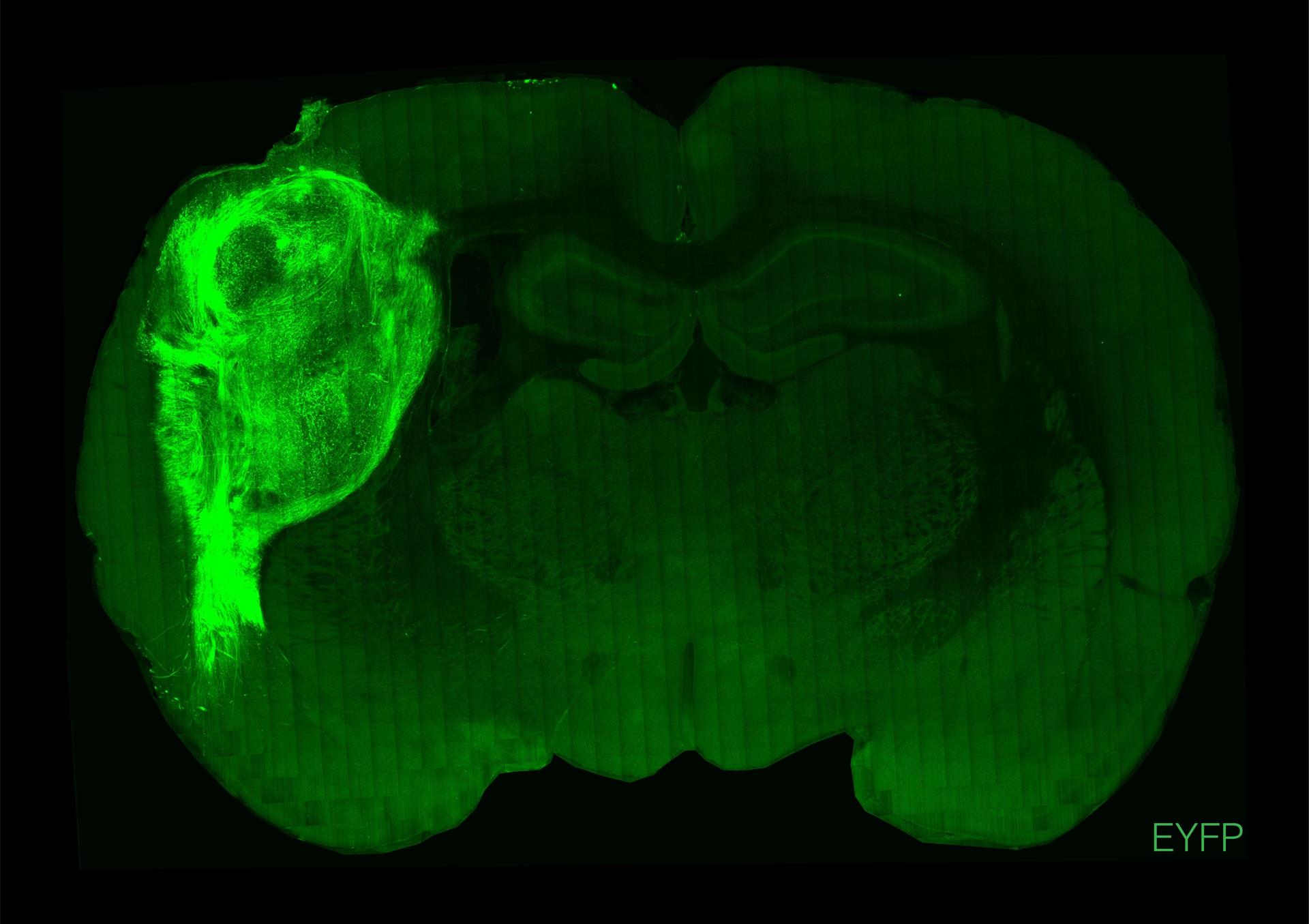 Un organoide humano trasplantado y marcado con una proteína fluorescente en una sección del cerebro de la rata.