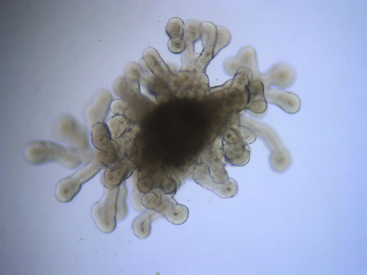 Micrografía de un minipulmón. Los organoides son versiones milimétricas de los órganos humanos que se fabrican, mediante métodos de cultivo celular, en los laboratorios.