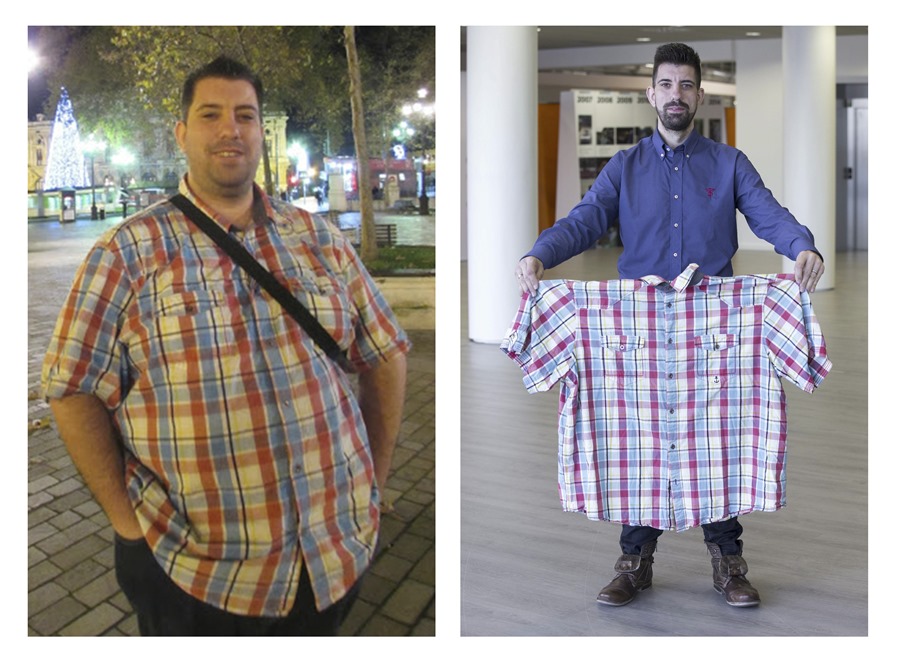 Fotografías del antes y después de Federico Moya, secretario de AB Hispalis, paciente que tenía obesidad.