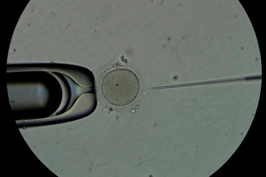 Personal técnico trabaja con espermatozoides en un laboratorio, en una imagen de archivo.