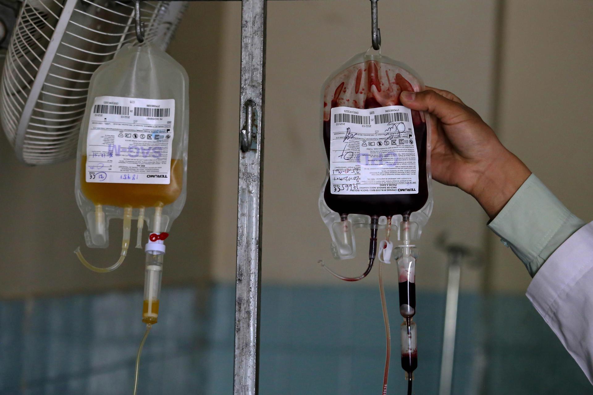 A staff at the Central Blood Bank checks blood bag in Kabul, Afghanistan, 06 April 2023 (issued 07 April 2023). EFE-EPA/SAMIULLAH POPAL