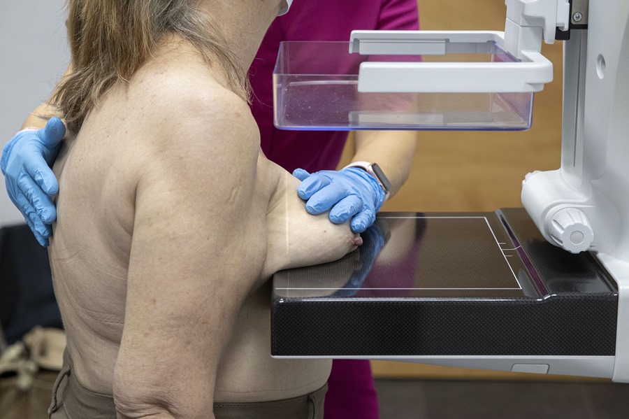 Una enfermera realiza una mamografía, en una imagen de archivo. Pigmento antitumoral contra el cáncer de mama