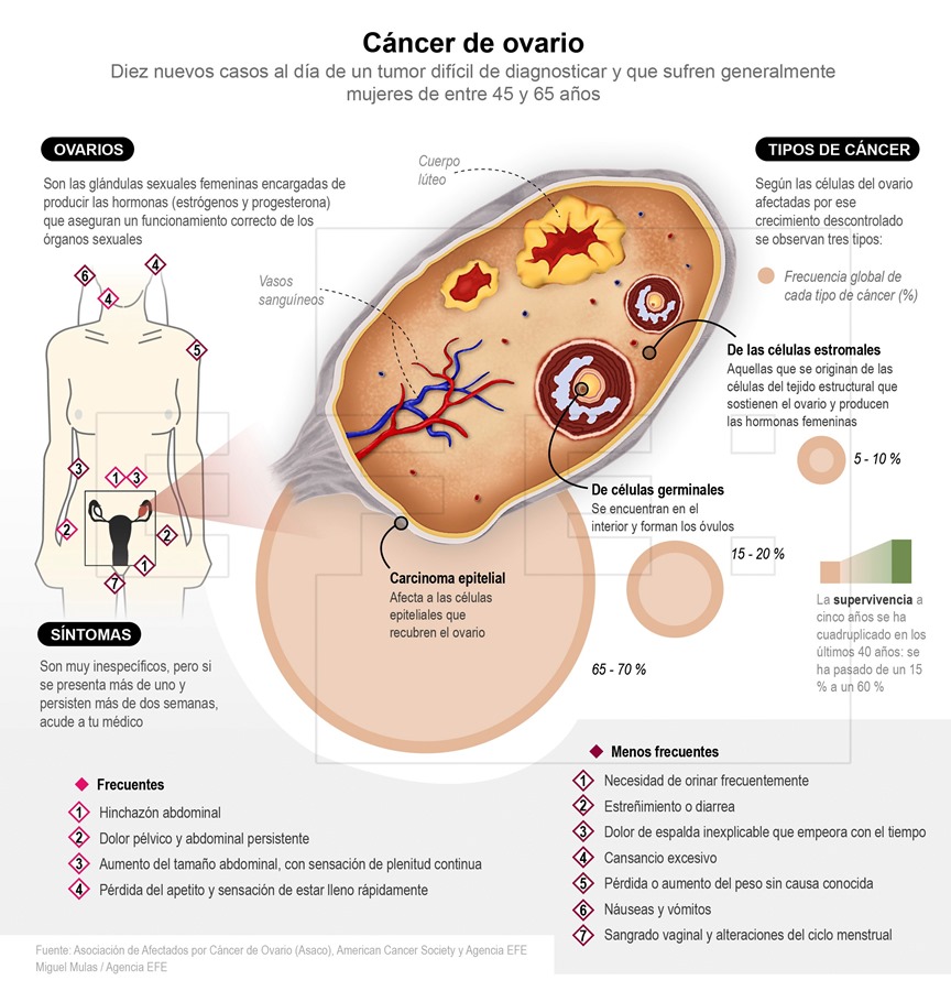 Infografía con información sobre el cáncer de ovario