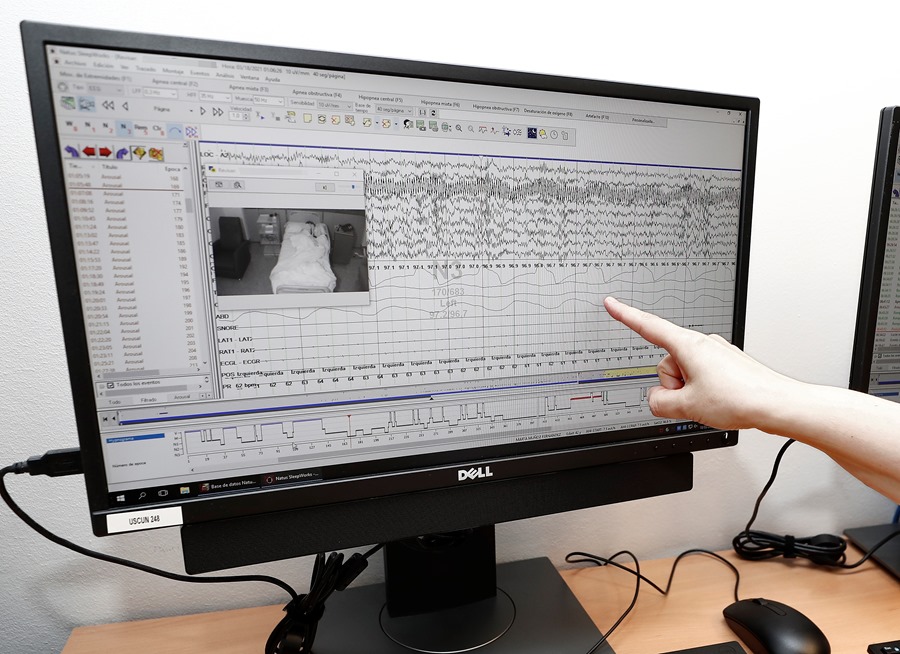 Una especialista de la Unidad del Sueño de la Clínica Universitaria de Navarra muestra sobre una pantalla una prueba del sueño, en una imagen de archivo.
