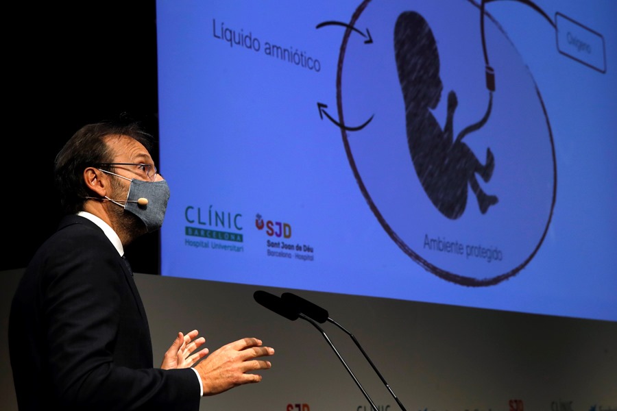 El director general de BCNatal, Eduard Gratacós, durante la presentación del proyecto de creación de una placenta artificial para salvar a bebés prematuros.