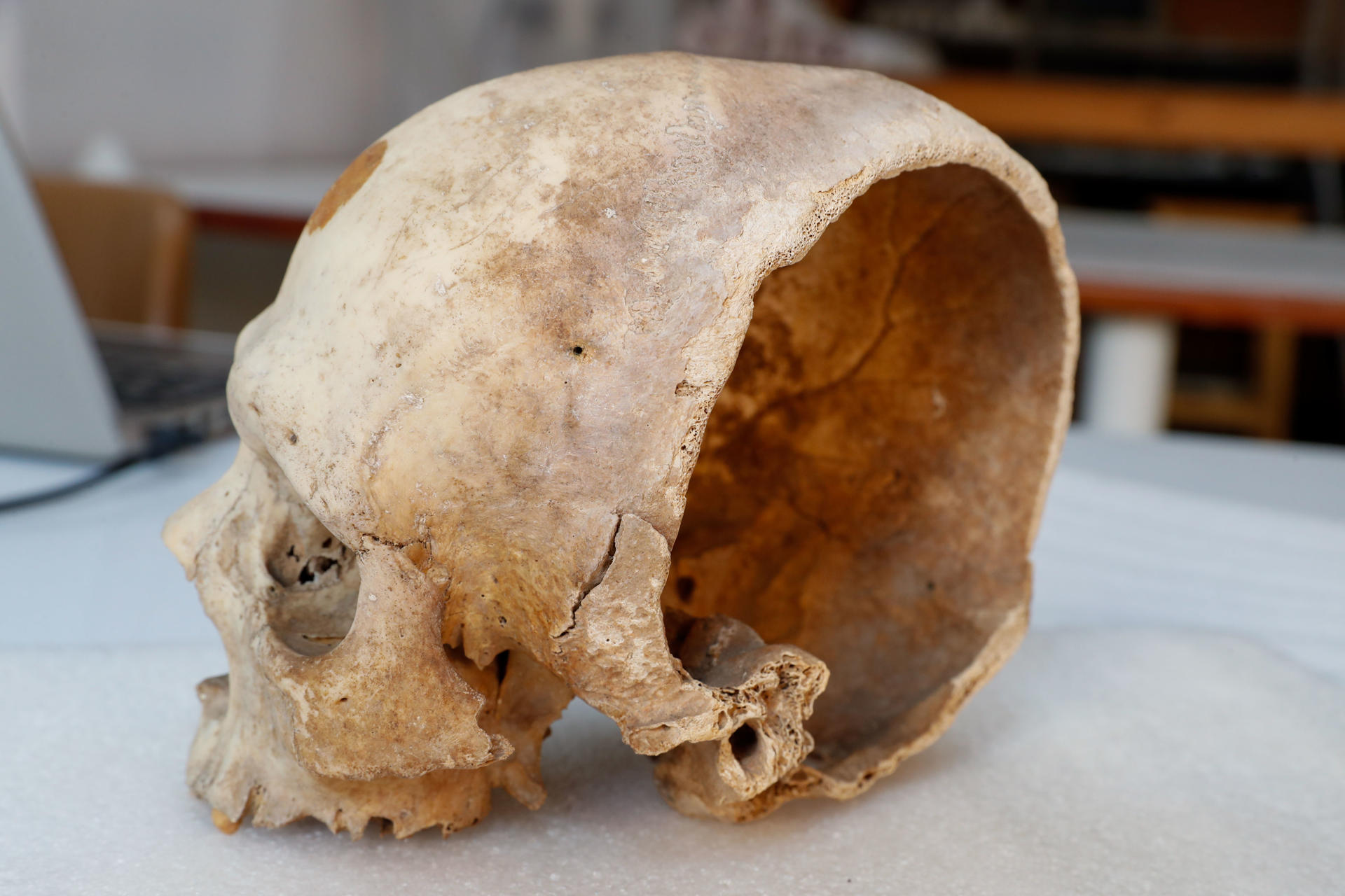 Cráneo de un varón aborigen canario datado entre los siglos XI y XII, seccionado por un golpe de espada. La pieza forma parte de los fondos del Museo Canario. EFE/Elvira Urquijo Á.
