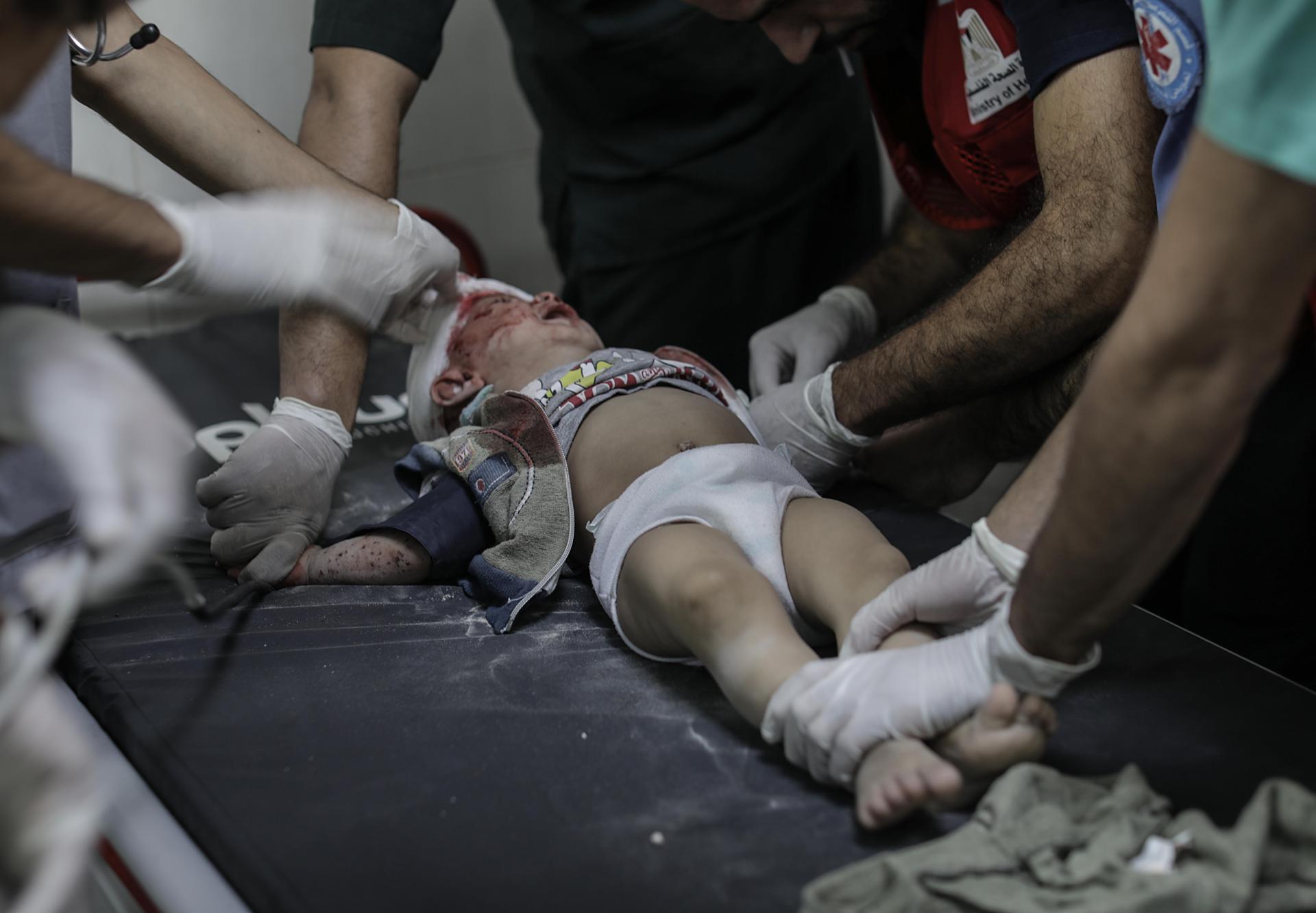 An injured Palestinian child who survived an Israeli airstrike is treated by a medical team at Nasser Hospital in the Khan Yunis refugee camp, in the southern Gaza Strip, 21 October 2023. EFE/EPA/HAITHAM IMAD ATTENTION EDITORS: GRAPHIC CONTENT