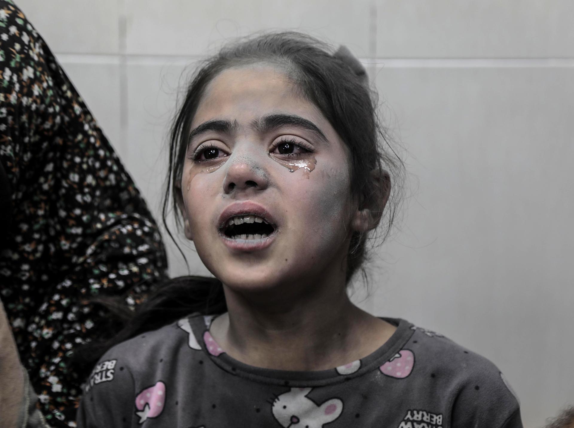 A Palestinian child wounded in an Israeli bombardment cries while being treated in a hospital in Khan Younis, in the southern Gaza Strip, 17 October 2023. EFE-EPA/HAITHAM IMAD